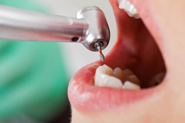 Best Same-Day Emergency Dental Services in Coal City, WV